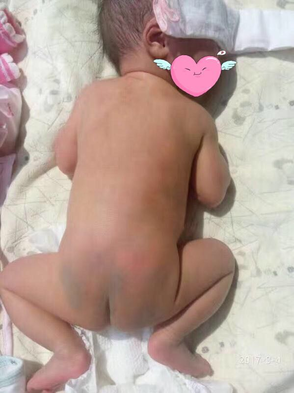 宝宝晒太阳