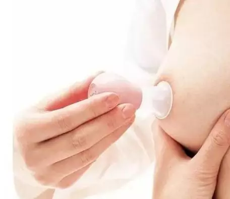 乳头吸引器.png